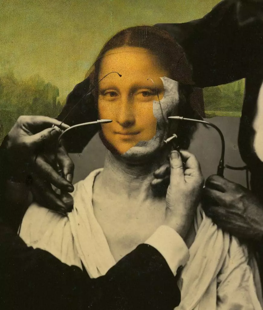 La greffe de peau révolutionnée