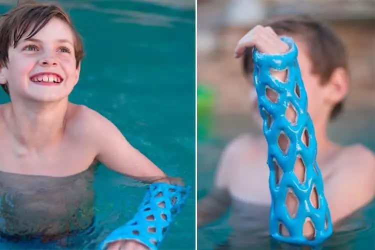 Un plâtre en résine imperméable pour aller dans l’eau avec un bras cassé !