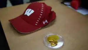 Cette casquette réveille les follicules pileux endormis Cette casquette réveille les follicules pileux endormis