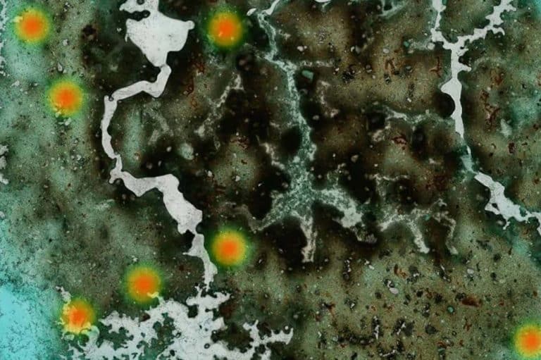Parasites intestinaux : l&rsquo;IA vous sauve la vie en un clic !