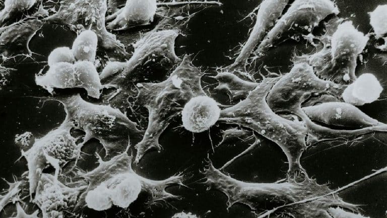 Cette découverte médicale pourrait révolutionner la lutte contre les tumeurs résistantes et sauver des millions de vies