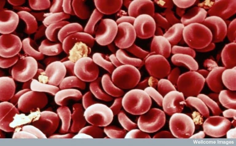 « Une découverte qui fait trembler la science » : ce nouveau groupe sanguin identifié après 50 ans de mystère pourrait bouleverser la médecine moderne