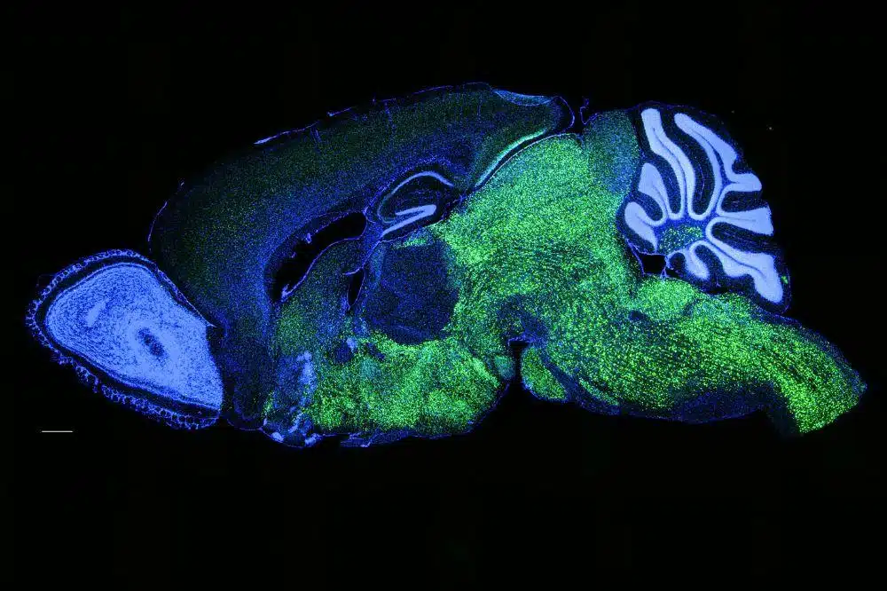 Cerveau de souris et le gène NOVA1