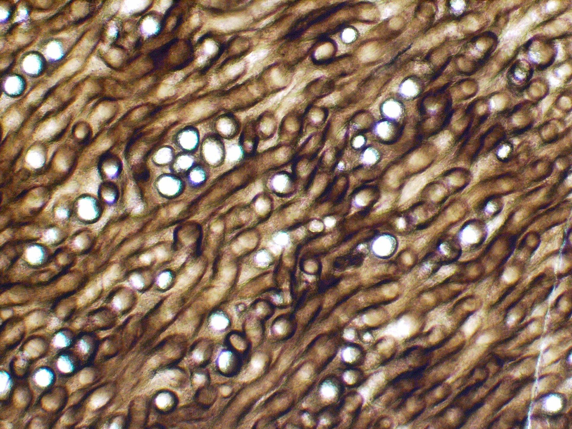 Prototaxites