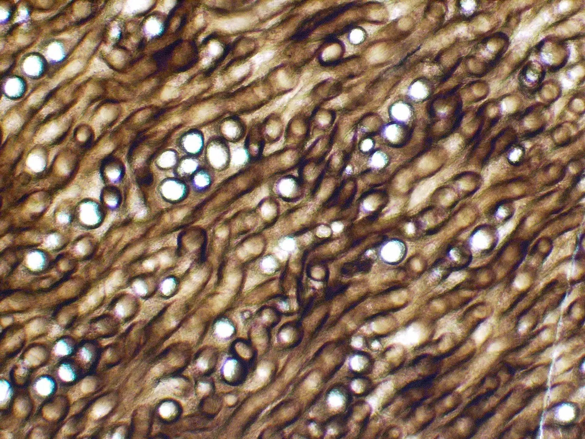 Prototaxites