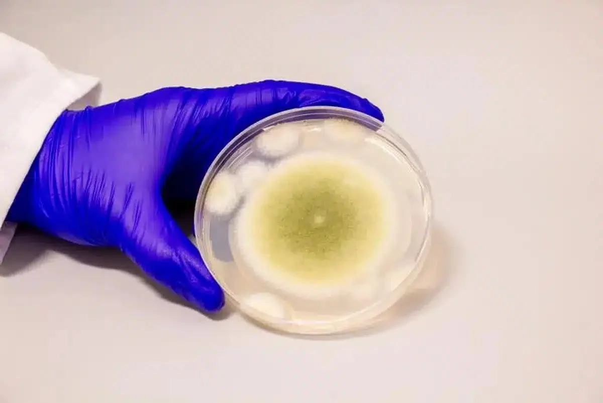 Champignon Aspergillus flavus et leucémie