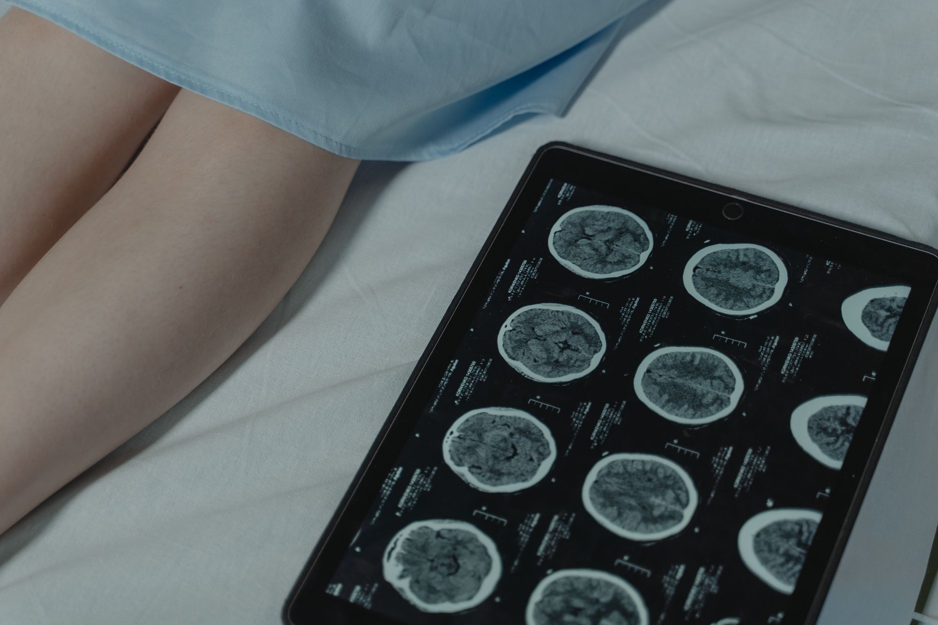 Sous psilocybine, le cerveau cache un ordre que l’IA révèle